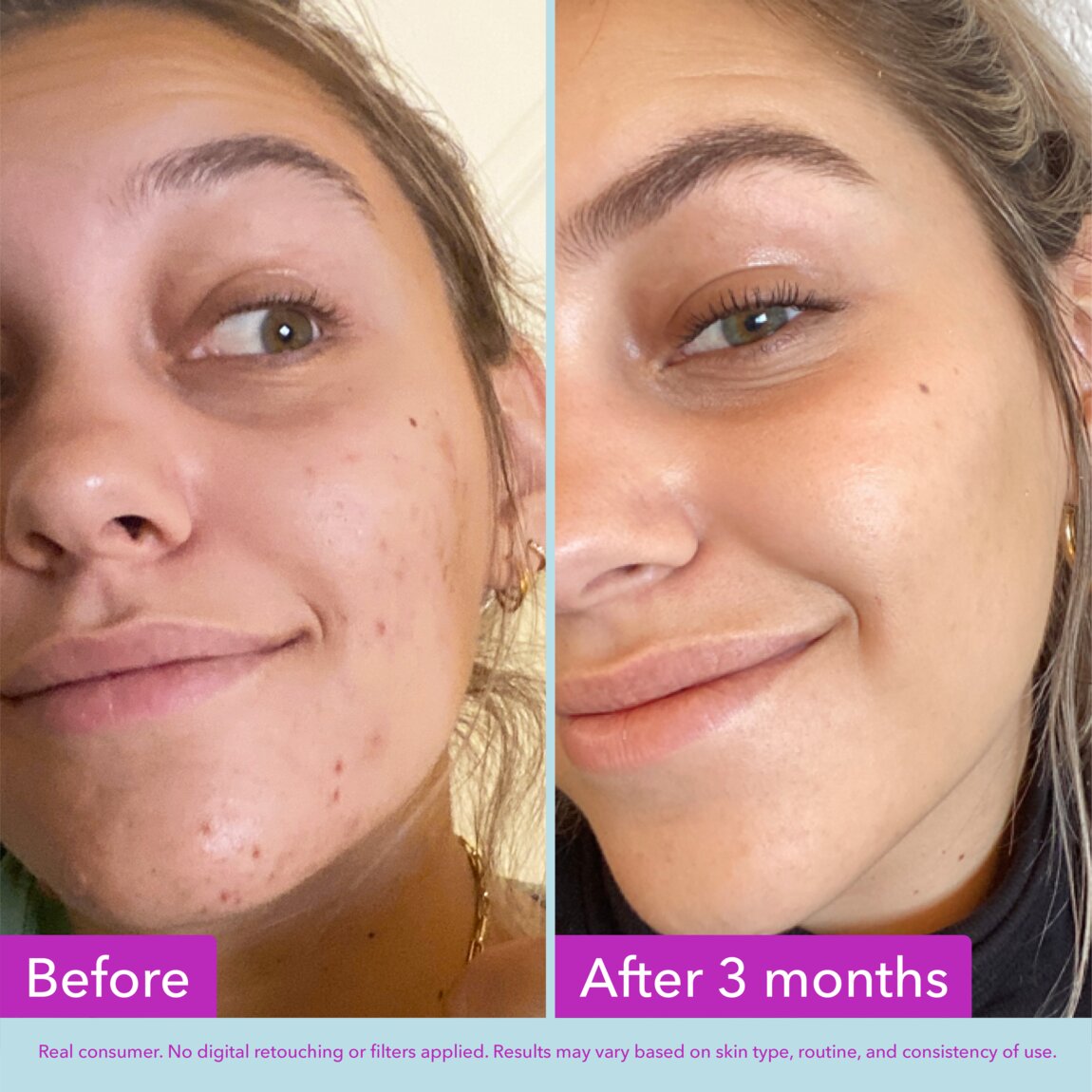 niacinamide-brightening-toner-e0 zb_p.jpg