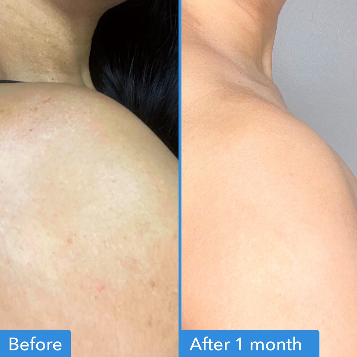 discoloration-correcting-body-treatment-k2 zb_p.jpg